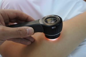 Cáncer-de-Piel